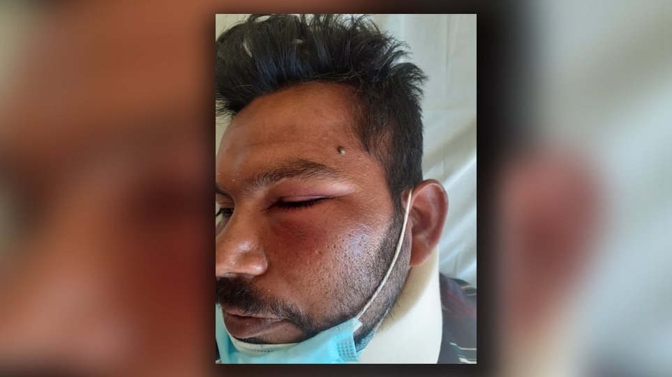 Καταγγελία για ξυλοδαρμό εργάτη στο Βαρθολομιό επειδή ζήτησε τα δεδουλευμένα του