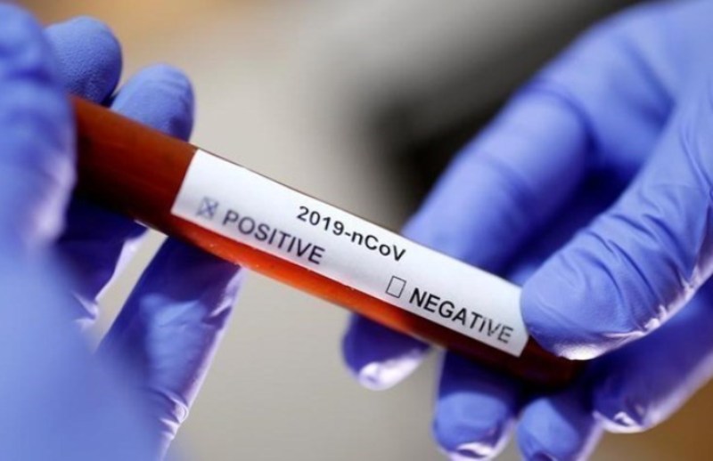 Έπεσαν κάτω από 20 τα νέα κρούσματα στην Πιερία – 1.358 στο σύνολο της χώρας