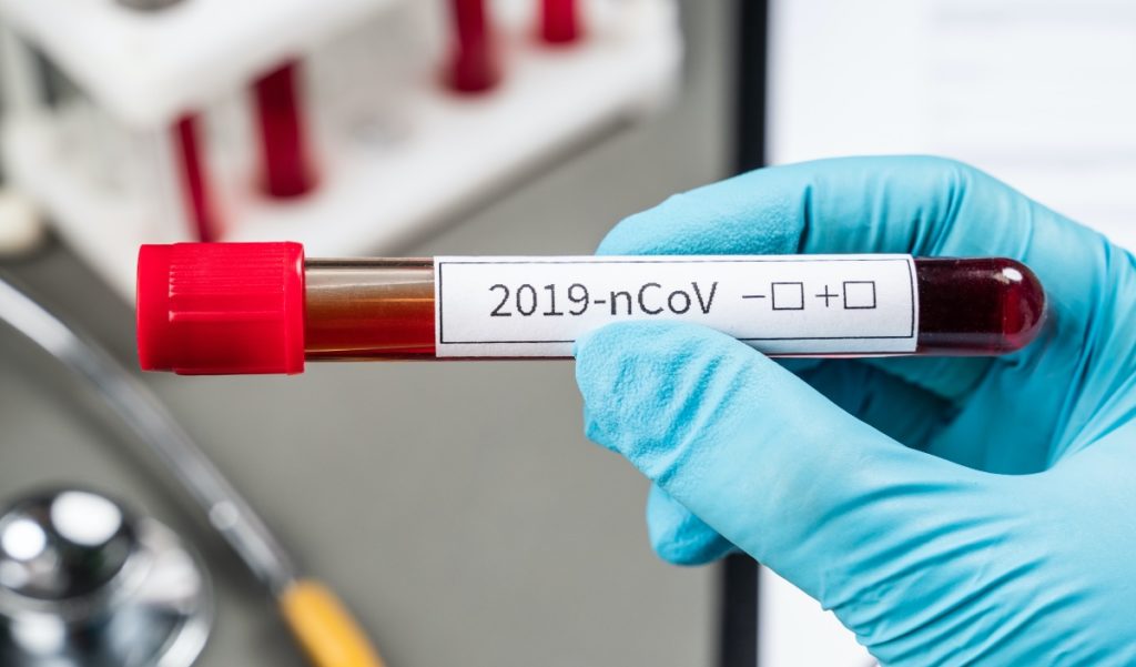 Στην Πιερία 18 από τα 3.133 σημερινά κρούσματα – 72 θάνατοι, 728 διασωληνωμένοι