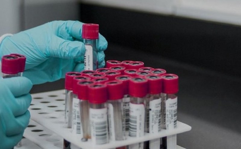 Πιερία: Παραμένει ψηλά στον αριθμό κρουσμάτων – 1.765 στη χώρα το τελευταίο 24ωρο