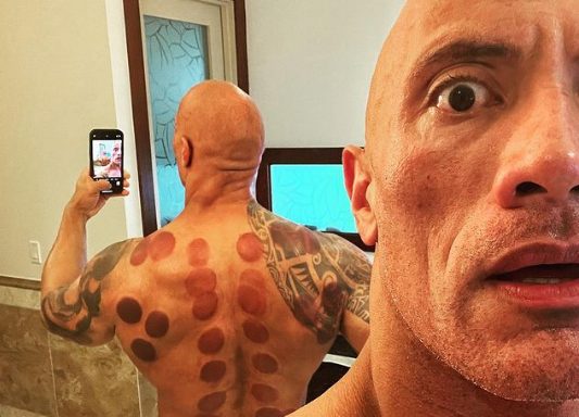 Ο Ντουέιν «The Rock» Τζόνσον το έριξε στις… βεντούζες!