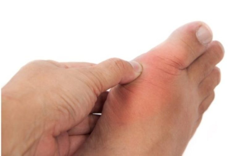 Αυξημένο ουρικό οξύ: Τα πιο κοινά συμπτώματα – Τι να προσέχετε