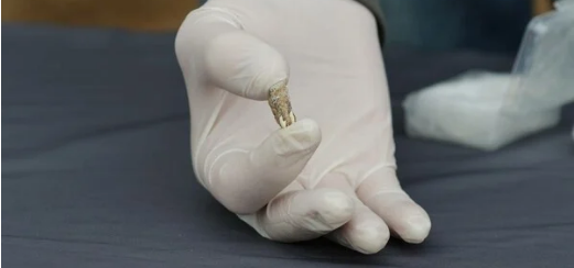 Παλαιοανθρωπολογικός θησαυρός στη Γεωργία: Βρέθηκε ανθρώπινο δόντι 1,8 εκατ. χρόνων