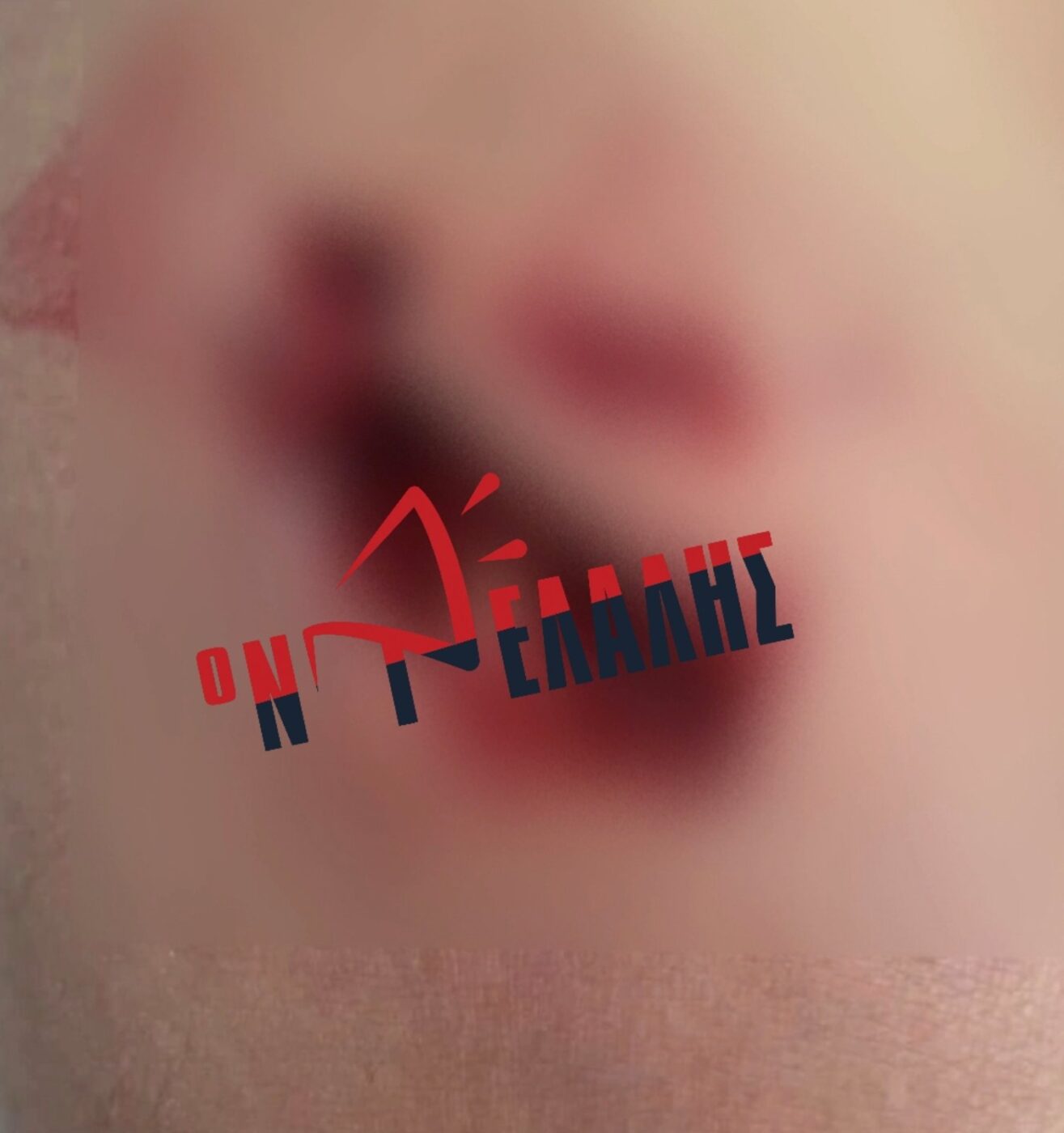 Επίθεση από αδέσποτο σκυλί δέχθηκε γυναίκα στο κέντρο της Κατερίνης